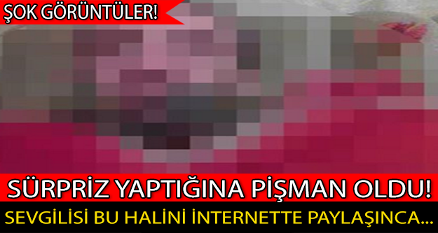 Sevgilisi Bu Halini İnternette Paylaşınca...