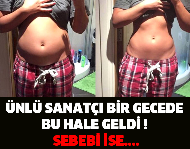 ÜNLÜ SANATÇI BİR GECEDE BU HALE GELDİ ! SEBEBİ İSE....