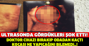 ULTRASONDA GÖRDÜKLERİ DEHŞETE DÜŞÜRDÜ... DOKTOR CİHAZI BIRAKIP ODADAN KAÇTI, KOCA NE YAPACAĞINI BİLEMEDİ...