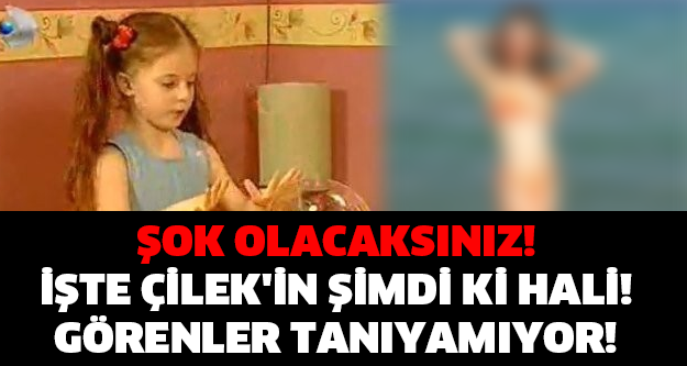 ŞOK OLACAKSINIZ! İŞTE ÇİLEK'İN ŞİMDİ Kİ HALİ! GÖRENLER TANIYAMIYOR!