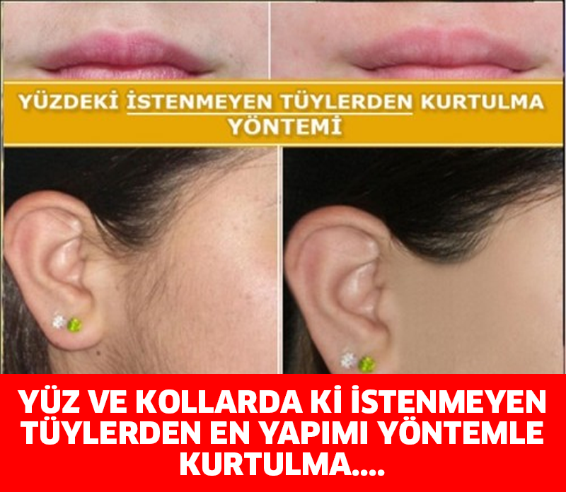 YÜZ VE KOLLARDA Kİ İSTENMEYEN TÜYLERDEN EN YAPIMI YÖNTEMLE KURTULMA...