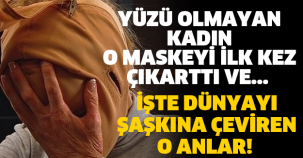 İŞTE DÜNYAYI ŞAŞKINA ÇEVİREN O ANLAR! YÜZÜ OLMAYAN KADIN O MASKEYİ İLK KEZ ÇIKARTTI VE...