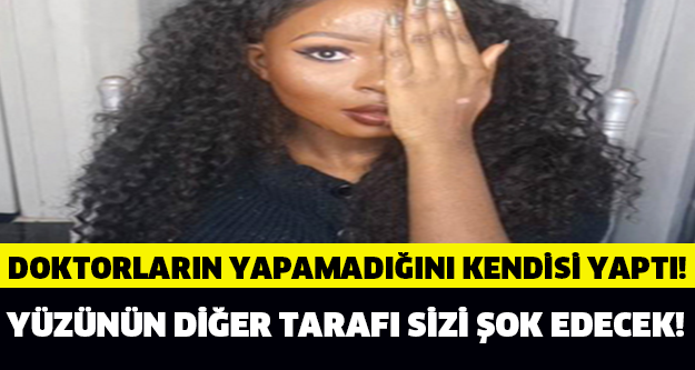 Yüzünün Diğer Tarafı Sizi Şok Edecek!