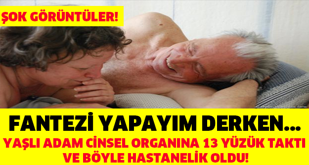 Fantezi Yapayım Derken Hastanelik Oldu!