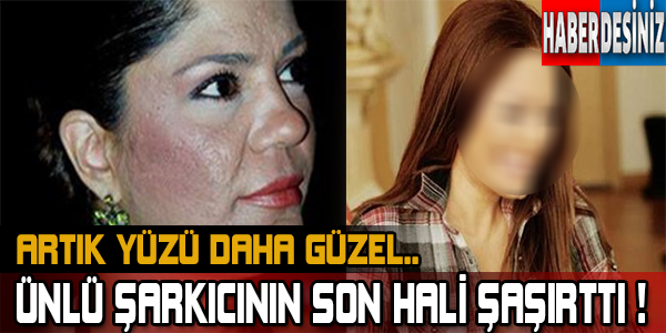 Ünlü Şarkıcının Son Hali Şaşırttı! Artık Yüzü Daha Güzel..