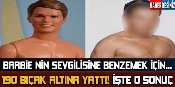 Barbie'nin sevgilisine benzemek için 190 kez bıçak altına yattı! İşte o sonuç...