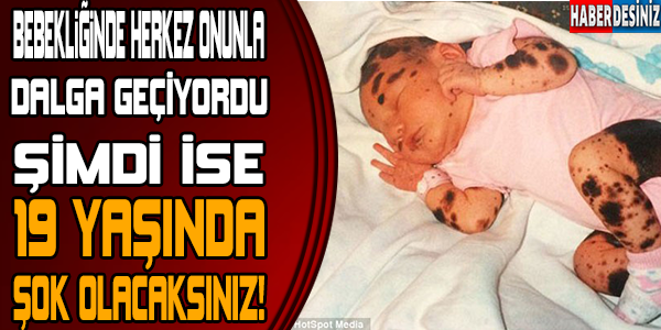 BEBEKLİĞİNDE HERKES ONUNLA DALGA GEÇİYORDU! ŞİMDİ 19 YAŞINDA!