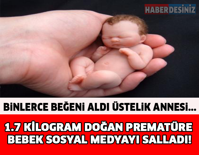 1.7 KİLOGRAM DOĞAN PREMATÜRE BEBEK SOSYAL MEDYAYI SALLADI!