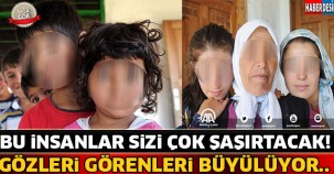 Bu İnsanların Gözleri Herkesi Büyülüyor ! Görünce Şoke Olacaksınız...