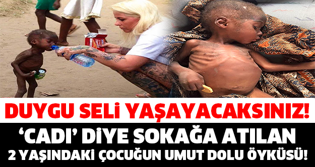 Duygu Seli Yaşayacaksınız: 'Cadı' Diye Sokağa Atılan 2 Yaşındaki Çocuğun Umut Dolu Öyküsü