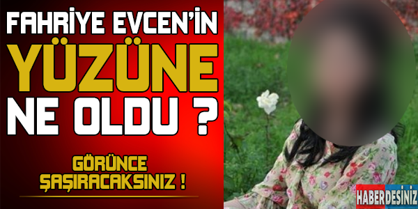 Fahriye Evcen'in yüzüne ne oldu ? Görünce çok şaşıracaksınız...