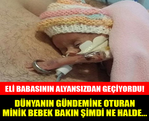 ELİ BABASININ ALYANSINDAN GEÇEN BEBEK, BAKIN ŞİMDİ NE HALDE...