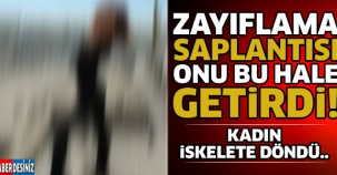 Zayıflama Uğruna Bu Hale Geldi ! İskelet Oldu..