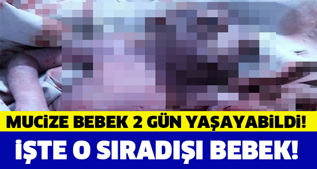 Sıradışı bebek 2 gün hayatta kalabildi!