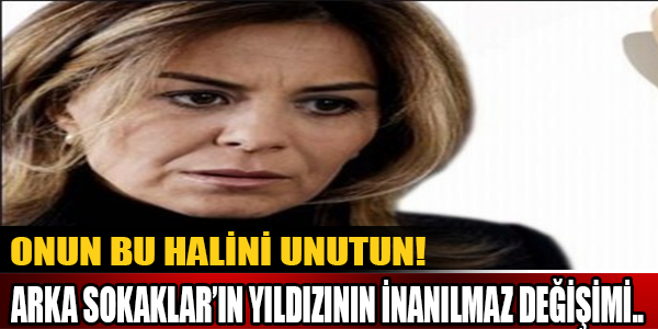 Onun Bu Halini Unutun! Arka Sokaklar'ın Yıldızının İnanılmaz Değişimi..