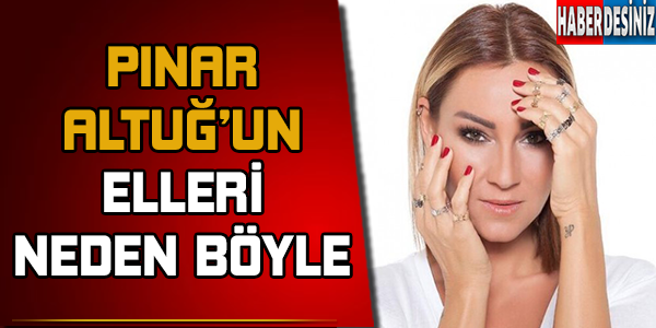 Pınar Altuğ'un elleri neden böyle?