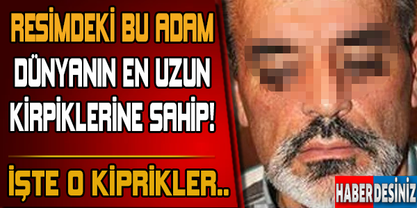 Dünyanın en uzun kirpikli insanı!