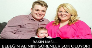 BEBEĞİN ALININI GÖRENLER ŞOK OLUYOR...