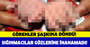 GÖRENLER ŞAŞKINA DÖNDÜ! 24 PARMAKLA DOĞDU