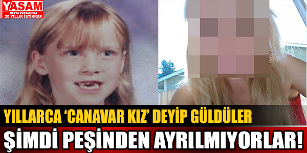 Yıllarca 'canavar kız' deyip güldüler şimdi ise peşinden ayrılmıyorlar!