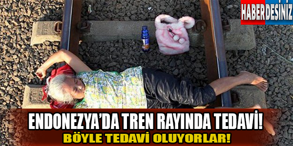 Endonezyada tren rayında tedavi!