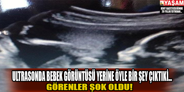 Ultrasonda bebek yerine öyle bir şey çıktıki...