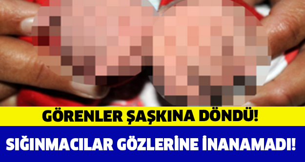 GÖRENLER ŞAŞKINA DÖNDÜ! 24 PARMAKLA DOĞDU