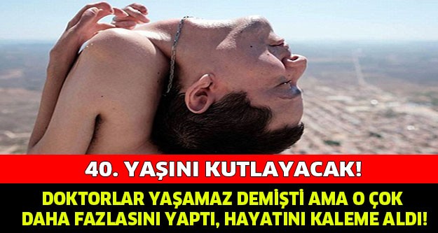 Boynu Ters Doğan Adam Hayatını Yazdı