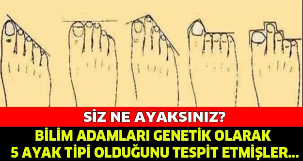 BİLİM ADAMLARI GENETİK OLARAK 5 AYAK TİPİ OLDUĞUNU TESPİT ETMİŞLER... PEKİ YA SİZ HANGİ AYAKSINIZ?