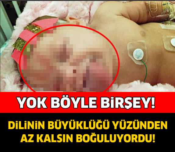 DİLİNİN BÜYÜKLÜĞÜ YÜZÜNDEN AZ KALSIN BOĞULUYORDU..!